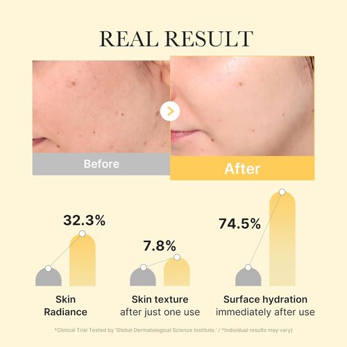 Medicube Kojic Acid Turmeric Jelly Gel Mask